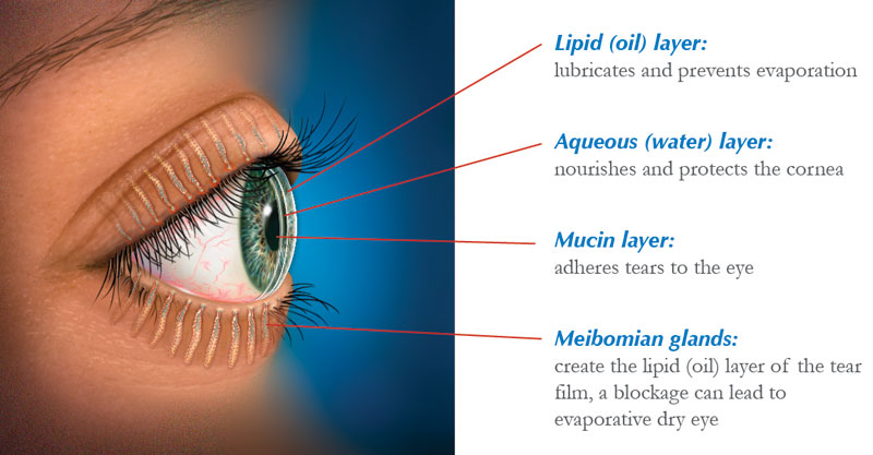 Dry Eye Westbrook | Glaucoma Greater Portland | Ocular Allergies ME