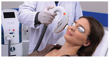 IPL Treatment IPL Treatment