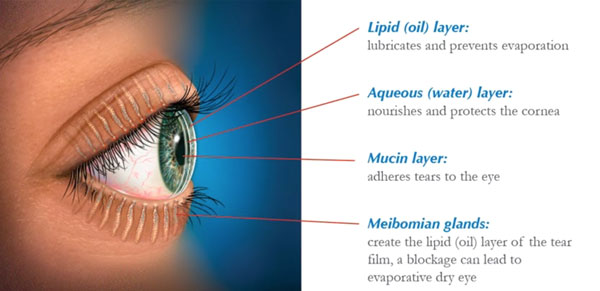 Dry Eye Diagram